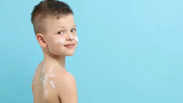 Çocukluk Döneminde Güneş Yanıkları: Cilt Kanseri Riski Yıllar Sonra Belirginleşiyor
